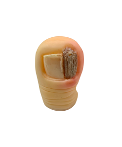 ONICOMATRICOMA