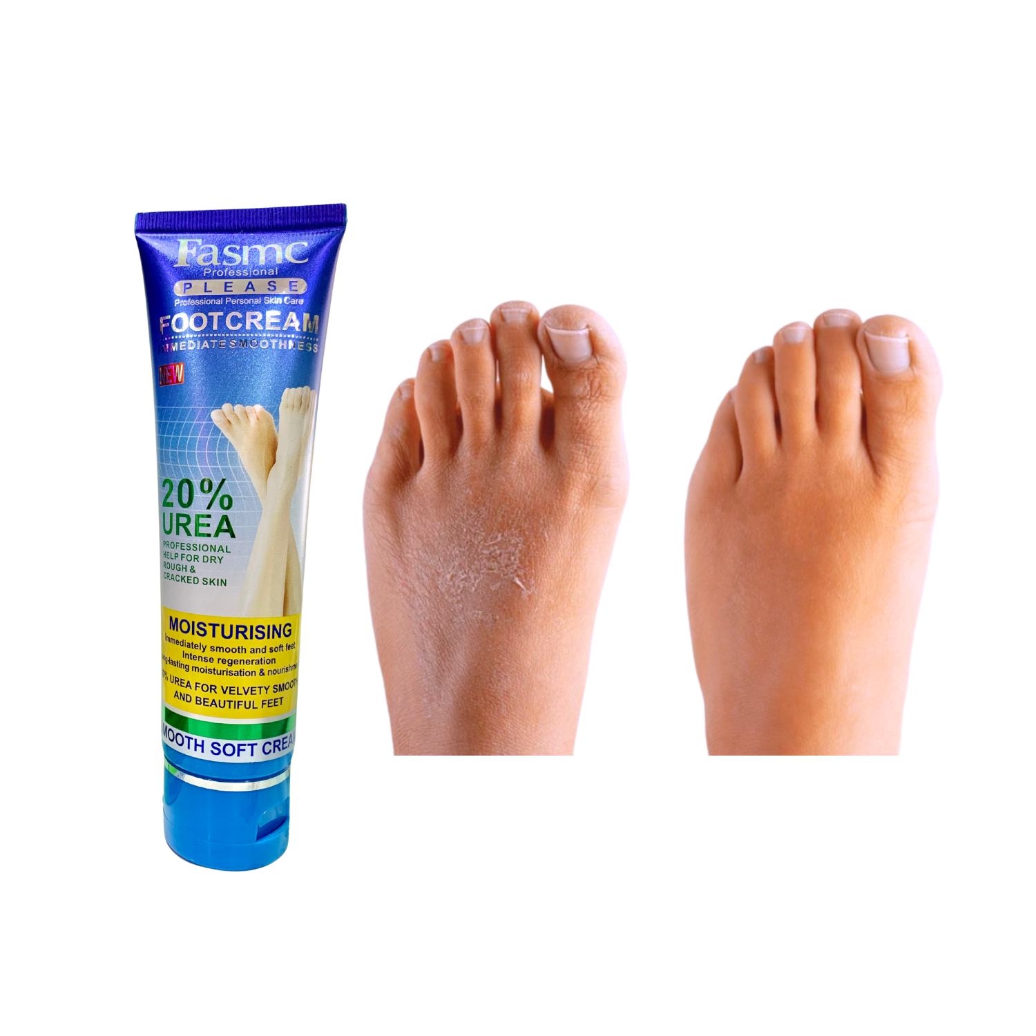 CREMA 20% UREA PARA PIES 100 ML - Imagen 3