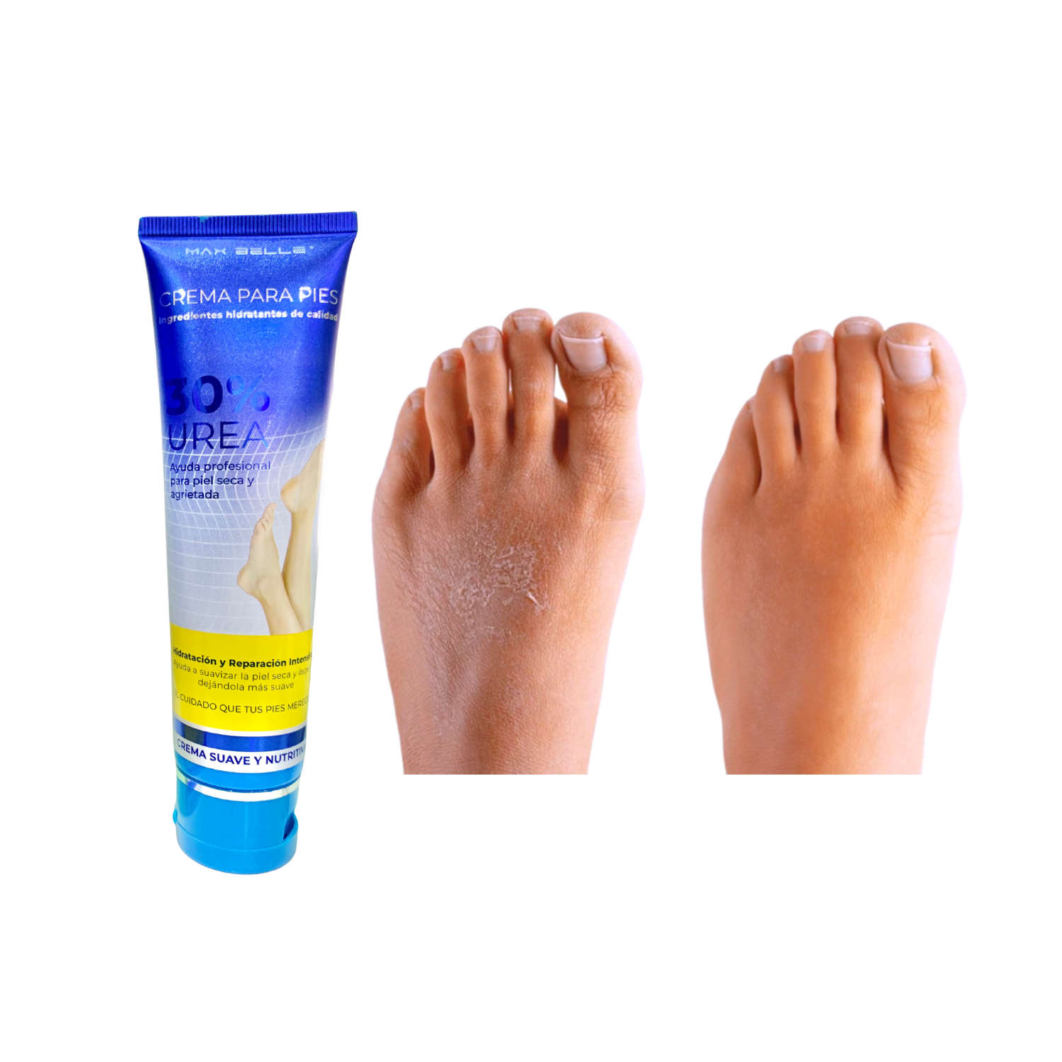 CREMA 25% UREA PARA PIES 100 ML - Imagen 3