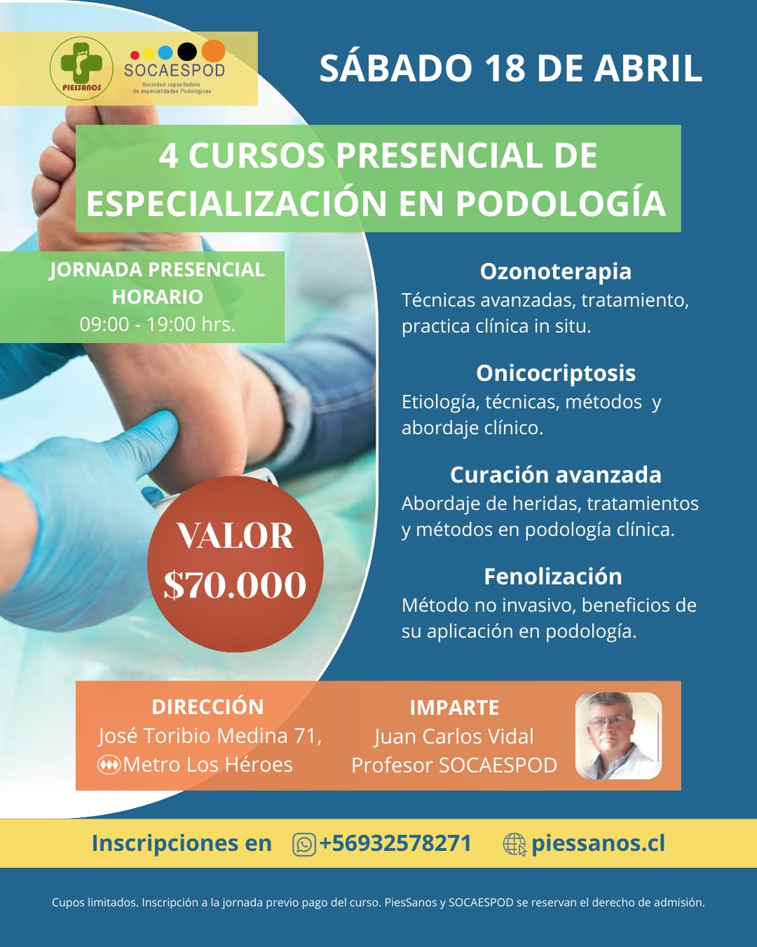 4 CURSOS EN 1 ( Fenolizacion-Onicocriptosis-Ozonoterapia-Curaciones Avanzadas)